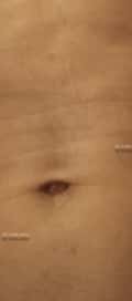 Acompanhante Erick