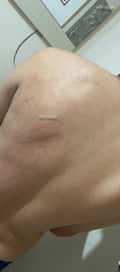 Acompanhante Branqueloo