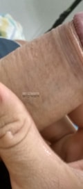 Acompanhante Sigilototal