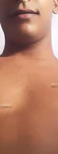 Acompanhante Silva