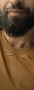 Acompanhante Peludinho Cb