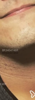 Acompanhante Massagemtântrica