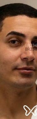 Acompanhante Patrick Costa