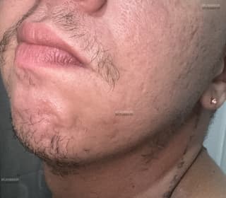 Acompanhante em Ulianópolis-PA - Nanorzinho